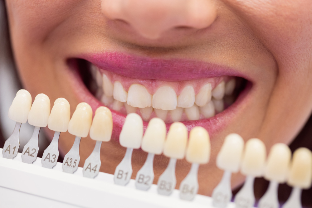 Best Dentist in Dahisar West
