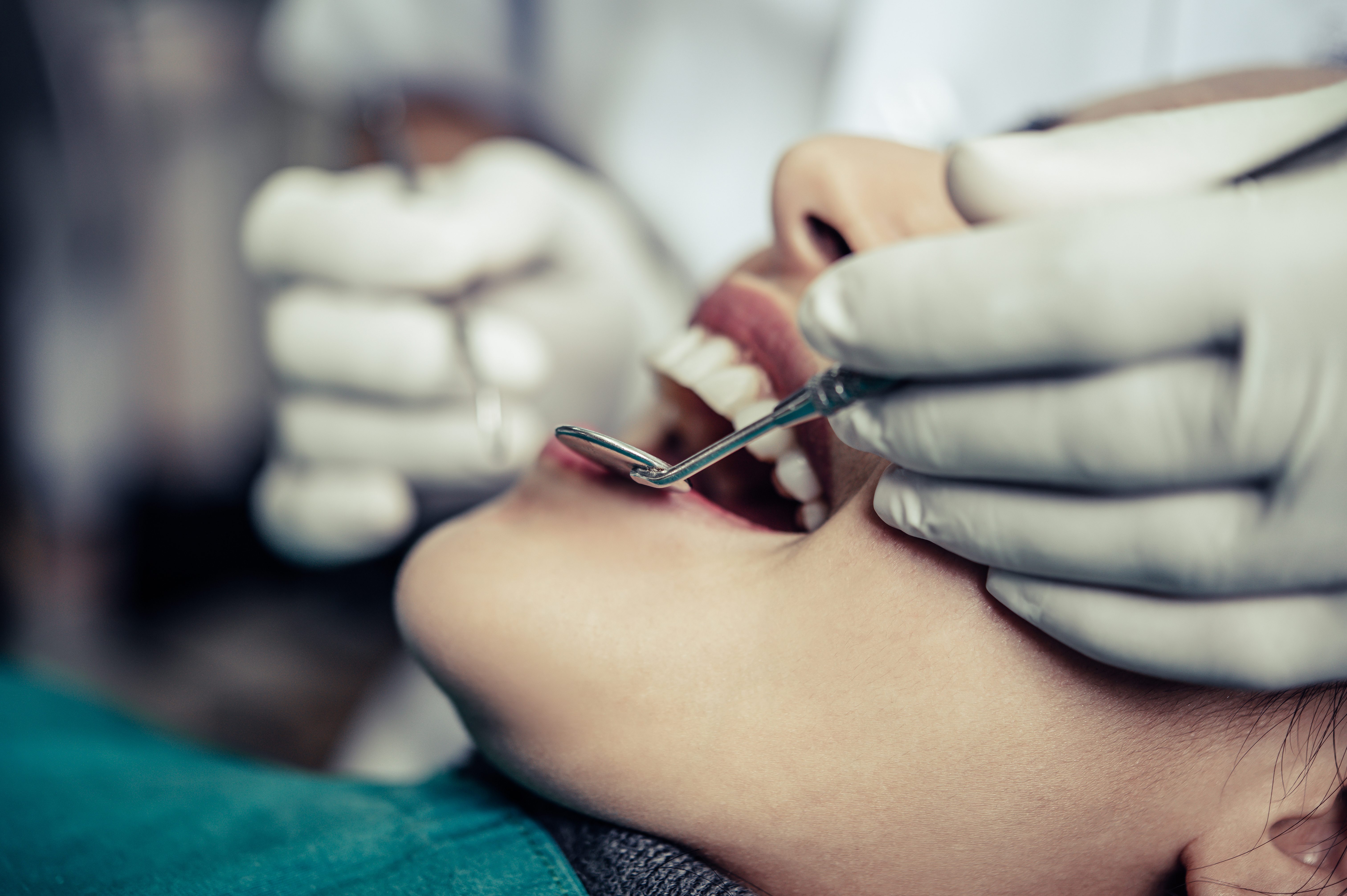 Dental Extraction in Dahisar West