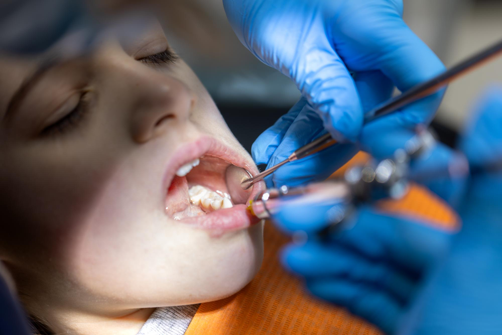 Minor Oral Surgery in Dahisar West