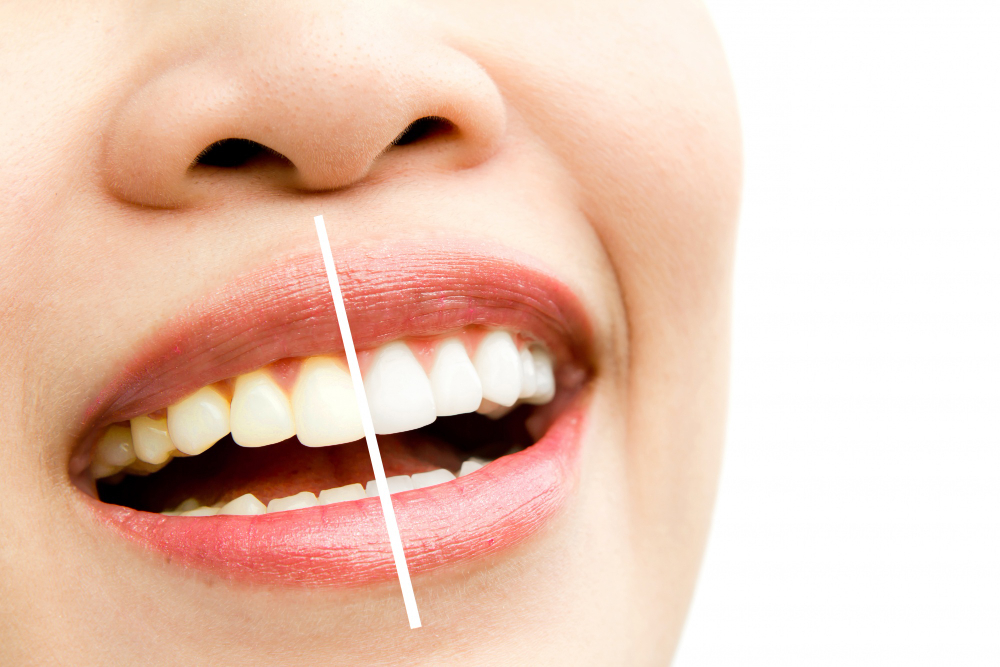 Best Dentist in Dahisar West